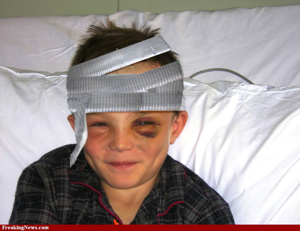 Duct-Tape-Bandages-for-Head-Injury-24505