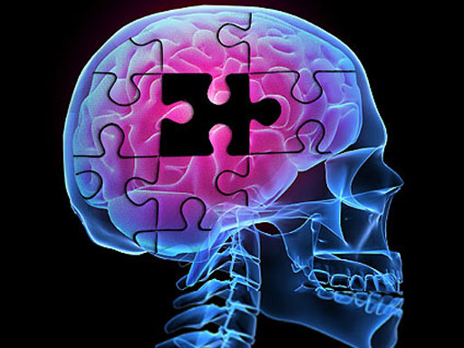 Alzheimer’s Before Symptoms Appear
