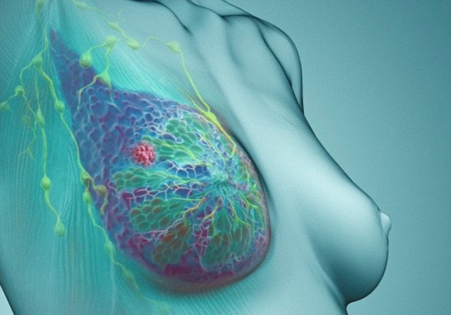 "First Lab-Grown Breast Sheds Light on Cancer Cell Progression"