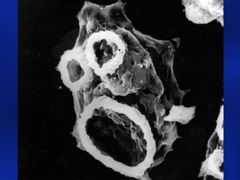"Naegleria fowleri amoeba brain-eating cell"