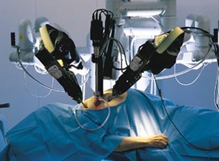 Robotic Surgeons Responsible For 144 Deaths
