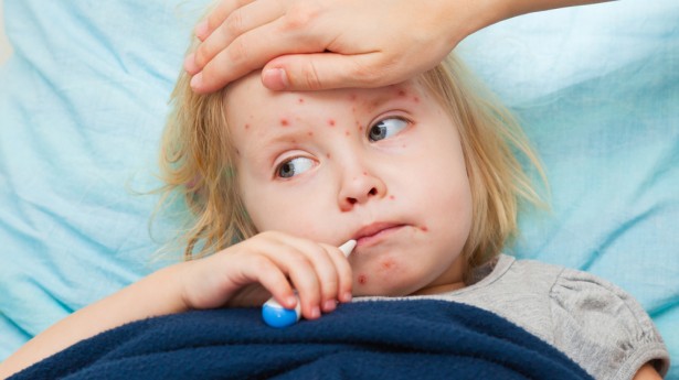 "measles epidemic threatens the united states"