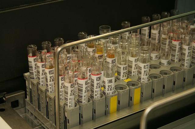 "Empty vials used for bloodwork."