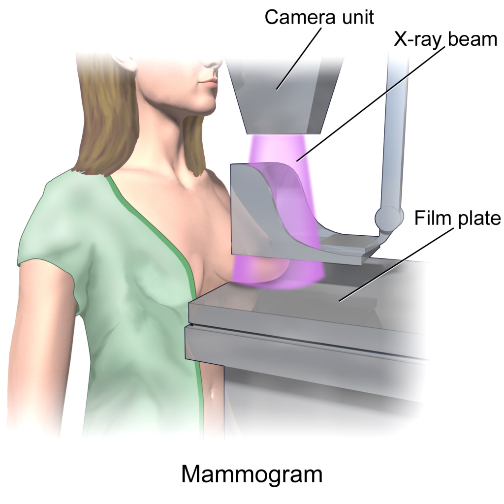 "mammogram illustration"