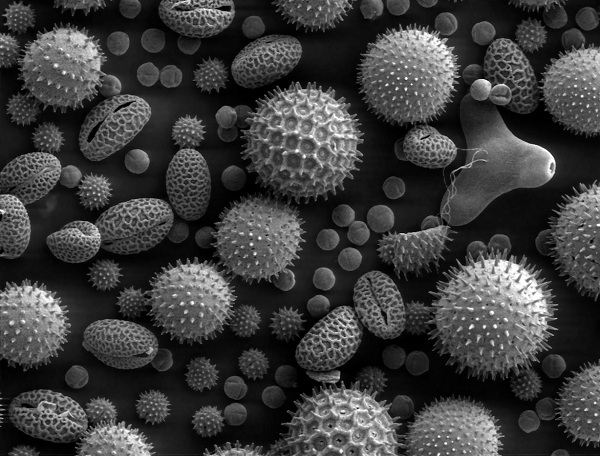 A scan made by an electron microscope