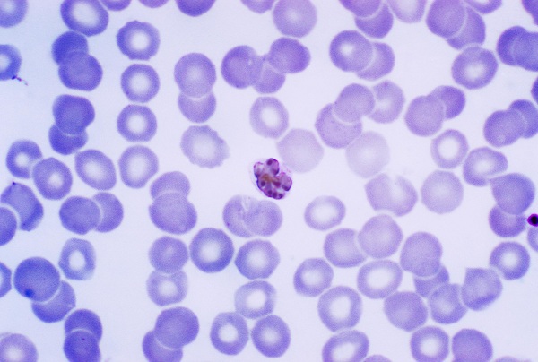 Malaria under microscope