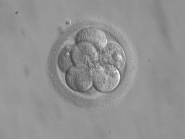embryo seen under the microscope